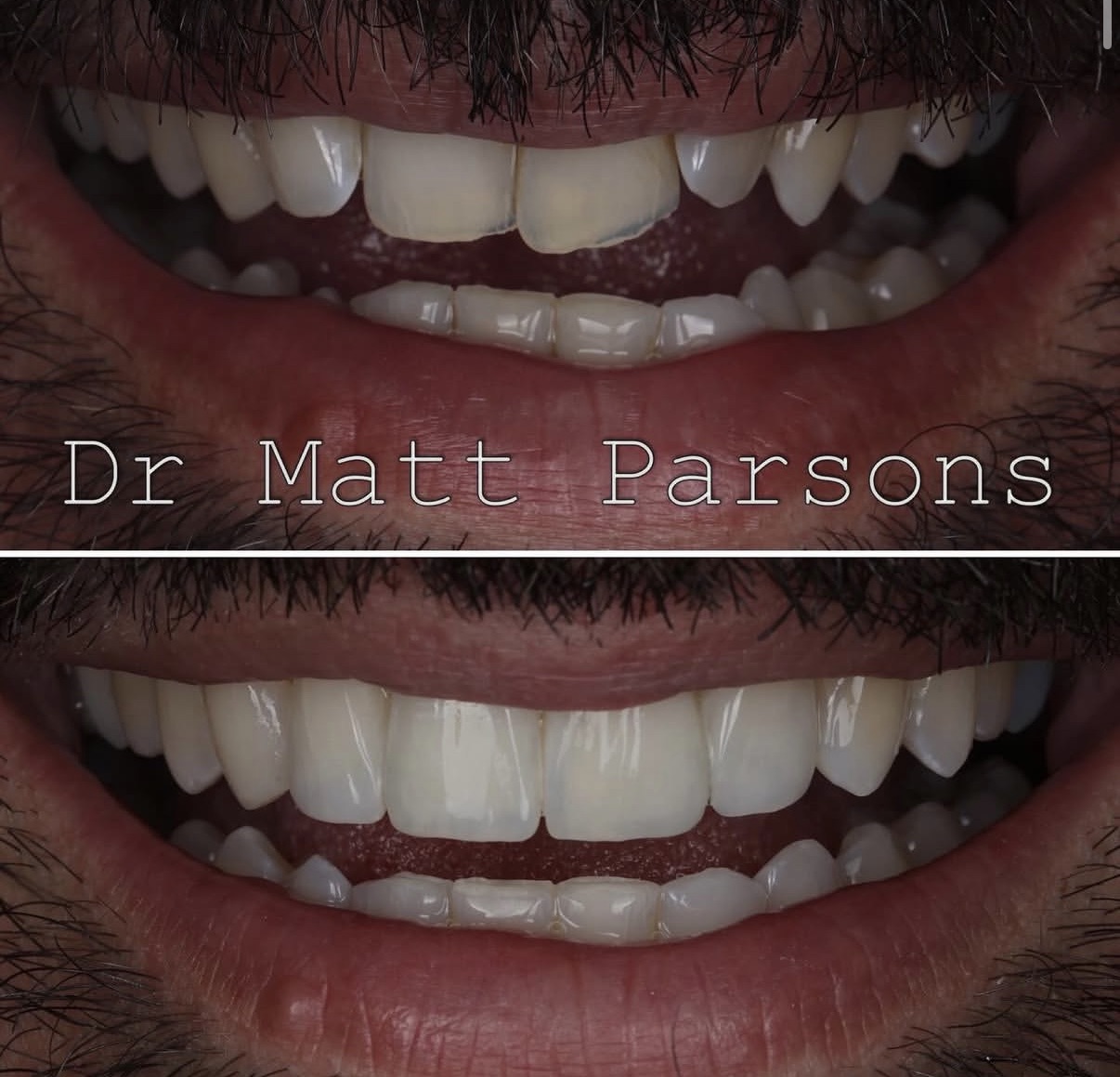 Instagram post by Dr. Matt Parsons
