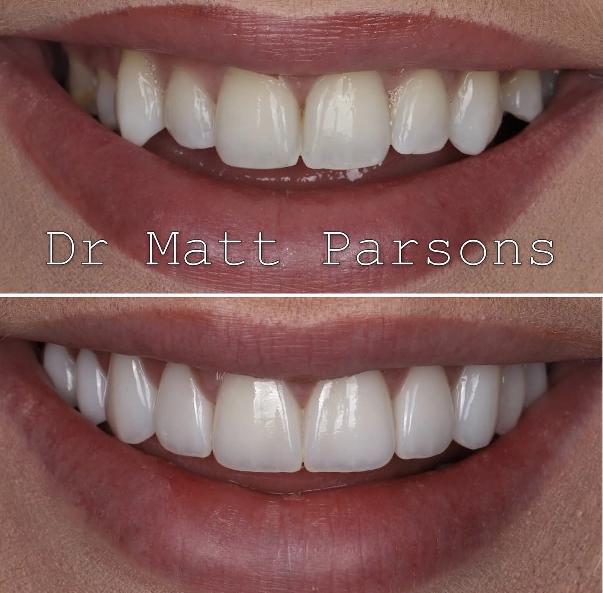 Instagram post by Dr. Matt Parsons